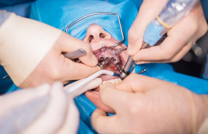 Does Health Insurance Cover Dental Surgery?