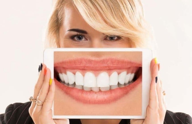 Dental Implants and Insurance: Will Star Health Help Pay the Cost?