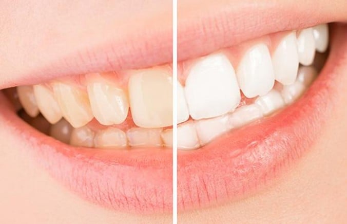 How to Achieve a Healthy and Confident Smile? The Essential Oral Health Guide Everyone Should Read