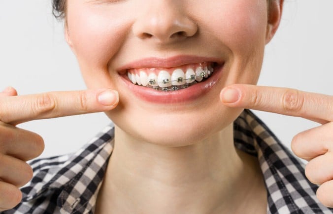 Teeth and Insurance: Does Your Health Plan Actually Pay for Dental Care?