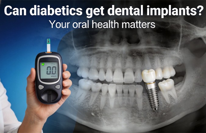 Can diabetics get dental implants?