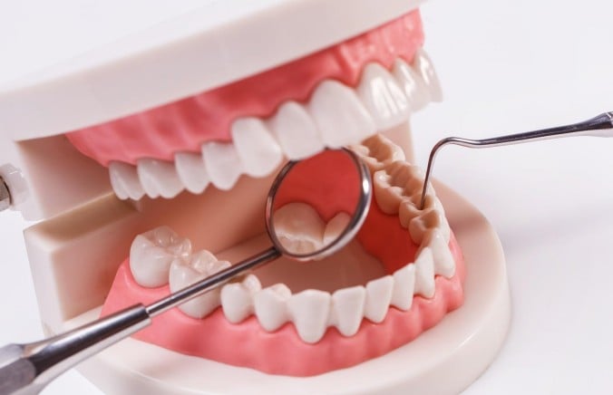 Why Is Dental Not Covered by Health Insurance?