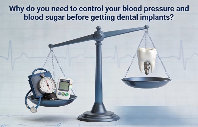 Why do you need to control your blood pressure and blood sugar before getting dental implants?