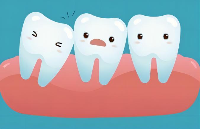 What are wisdom teeth?