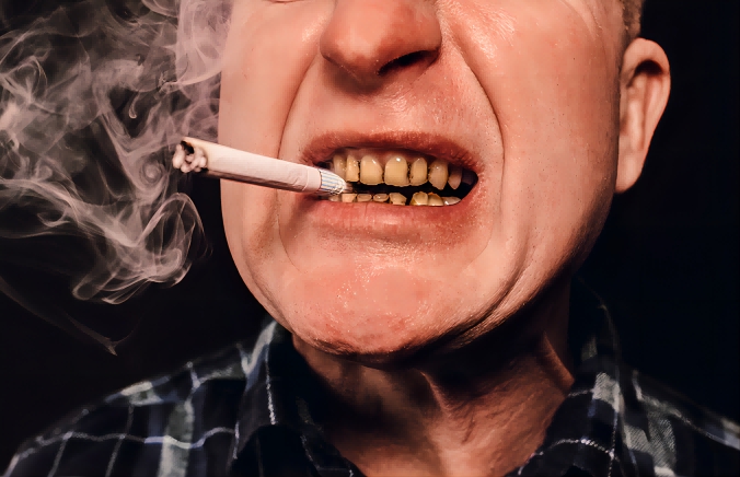 One of the culprits of oral health problems: smoking!