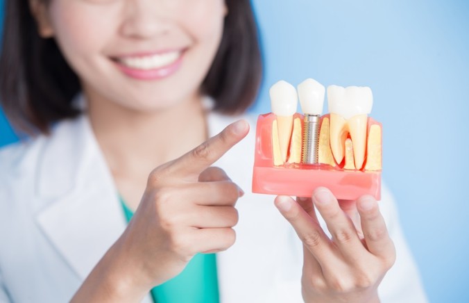 Does Health Insurance Cover Dental Implants? A Complete Guide for International Patients