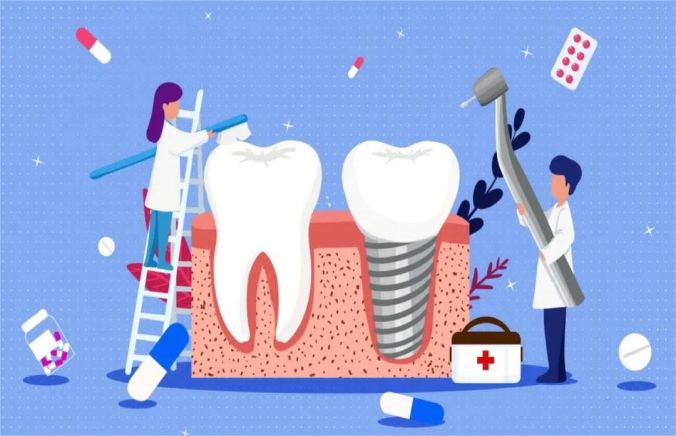 The latest technology and development trends of dental implants